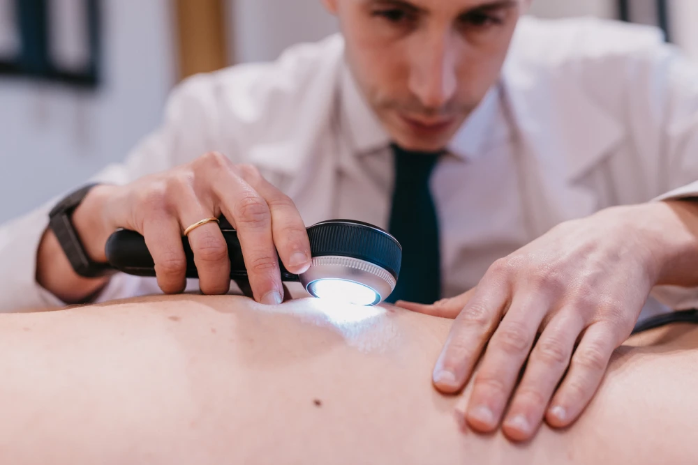 Tratamiento dermatitis seborreica en gijon